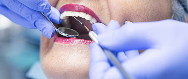 Best Emergency Dentist for Lost Fillings or Crowns in Moline, IL